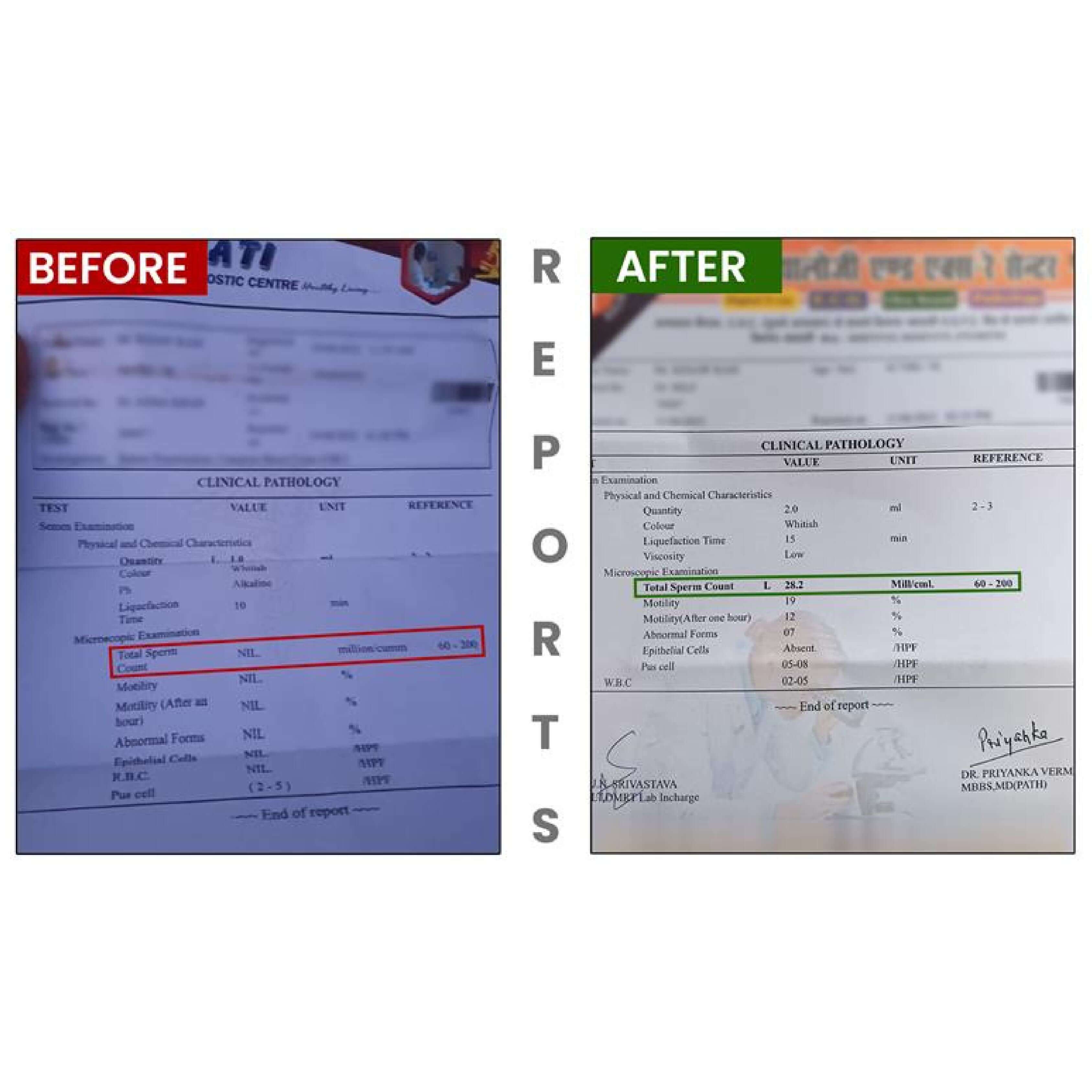 BeforeAfterfortasleenpagesimages4_g826d_3375