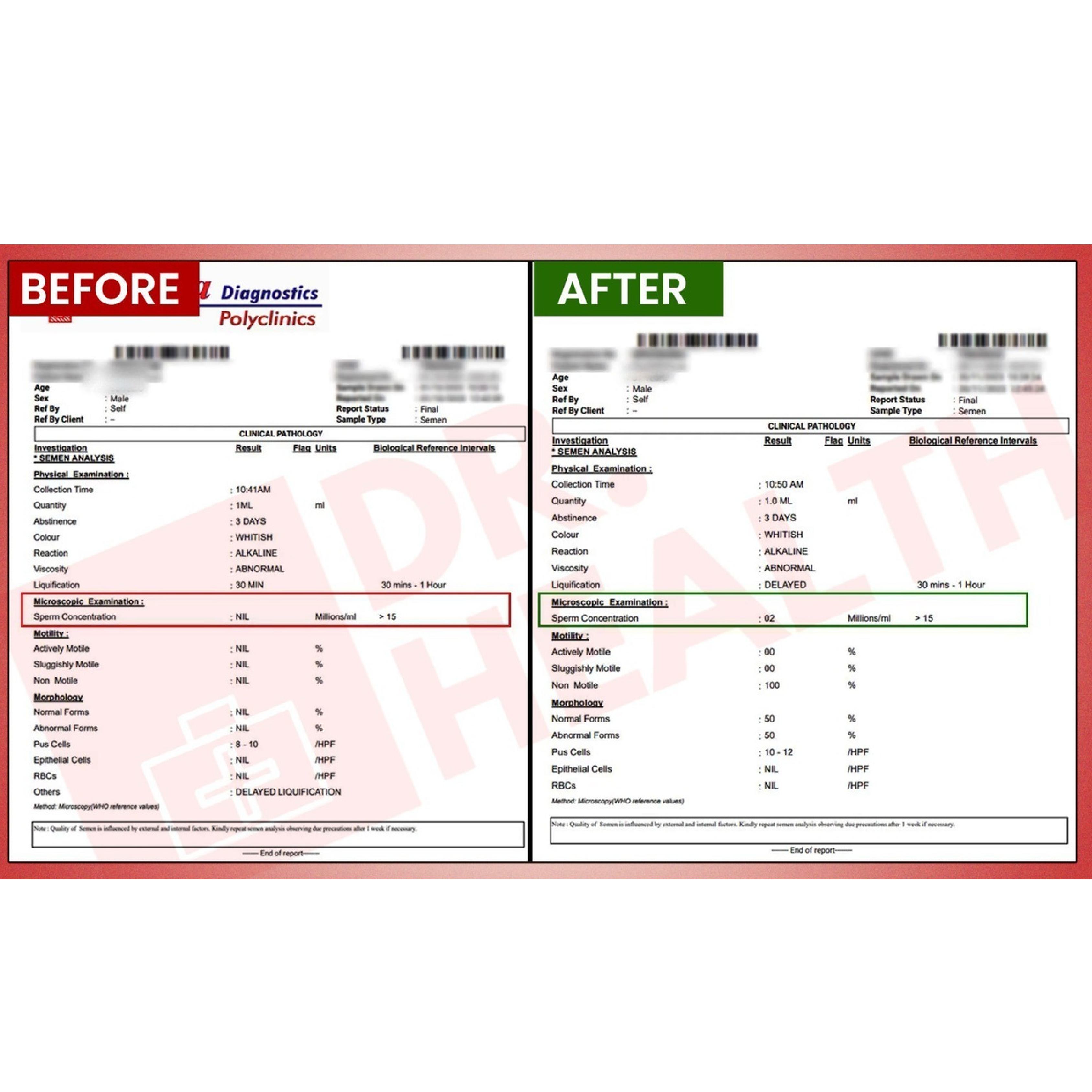 BeforeAfterfortasleenpagesimages5_wet1l_3375