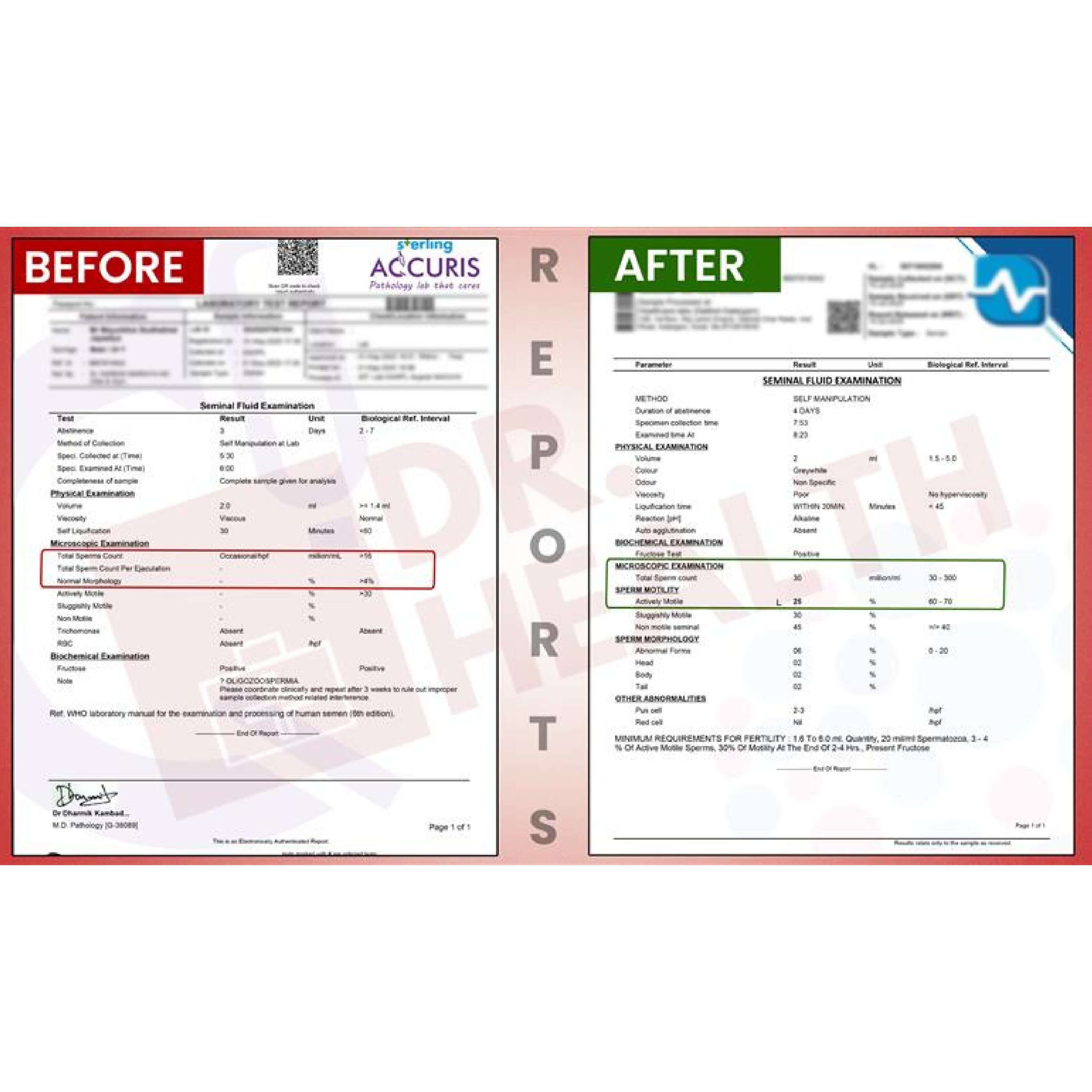 BeforeAfterfortasleenpagesimages6_ll8iw_3375
