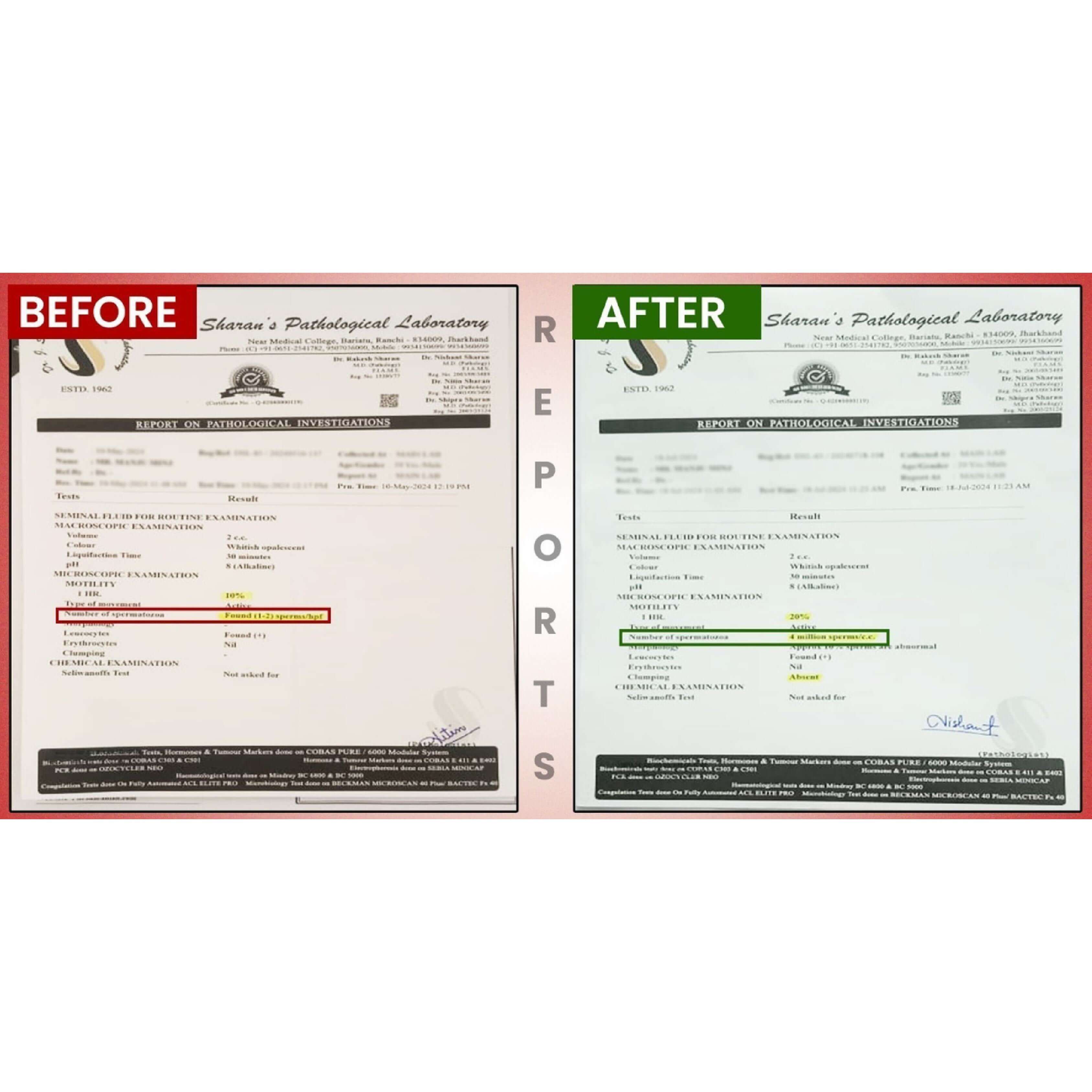 BeforeAfterfortasleenpagesimages7_qs6u7_3375