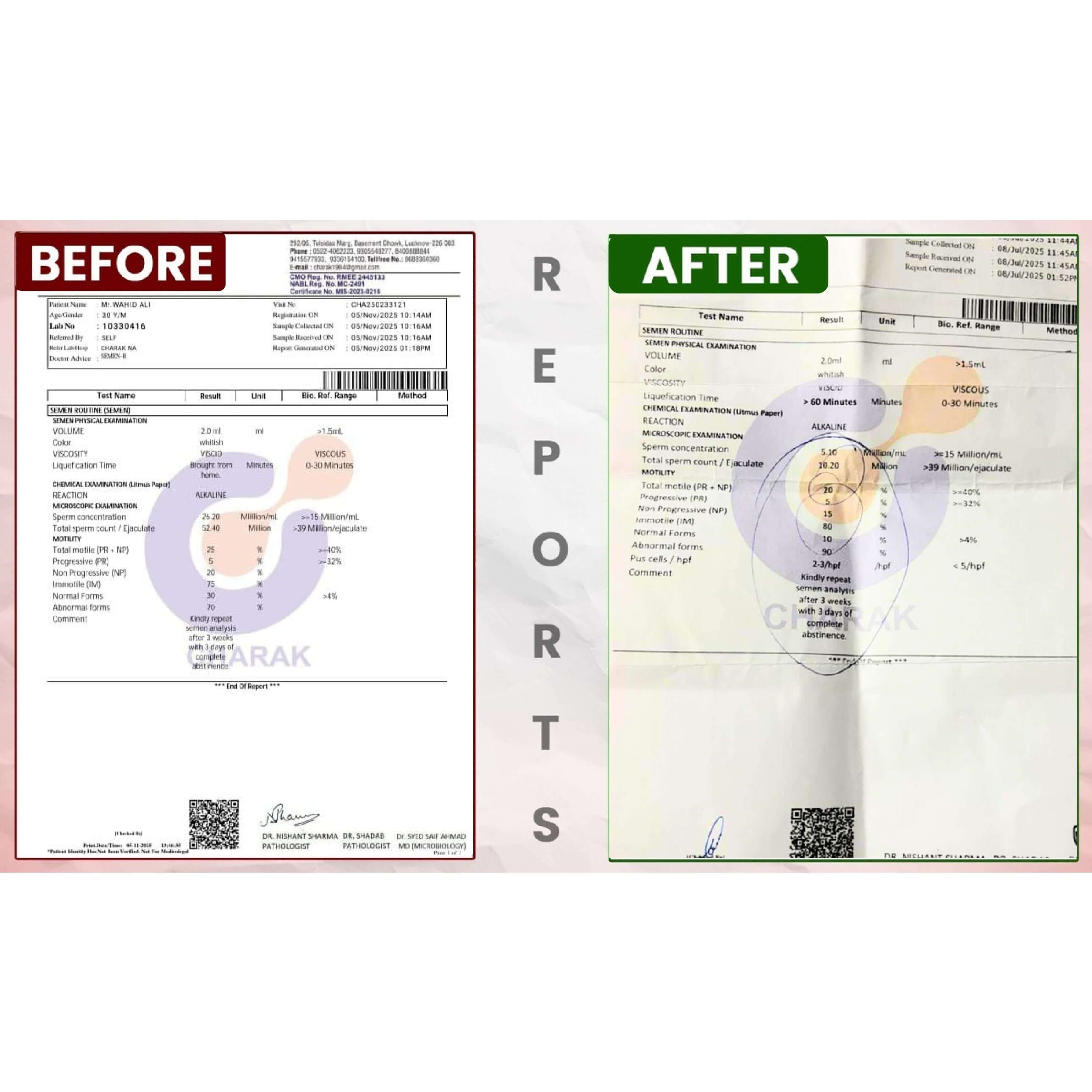 BeforeAfterfortasleenpagesimages8_tjiw6_3375