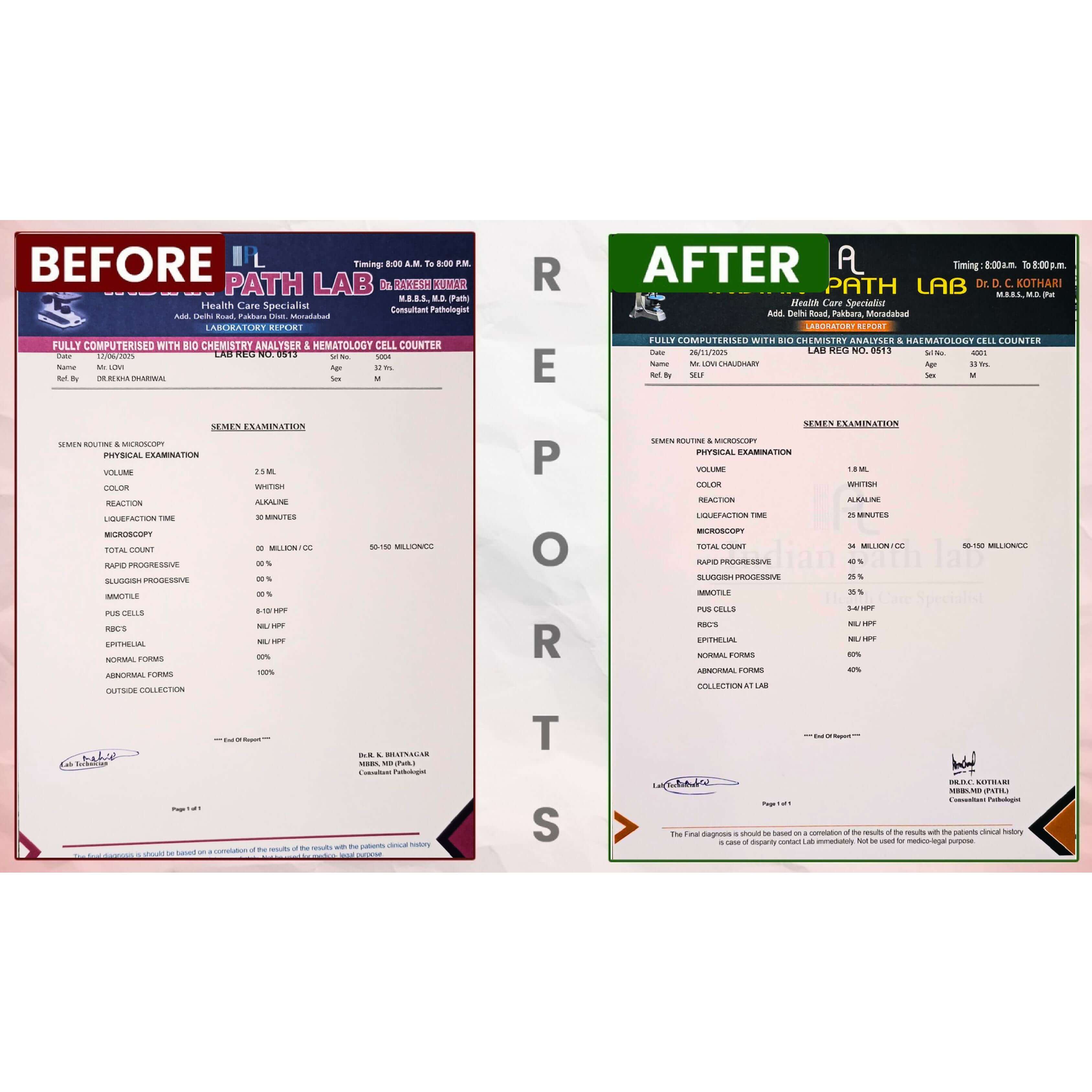 BeforeAfterfortasleenpagesimages9_y1oan_3375