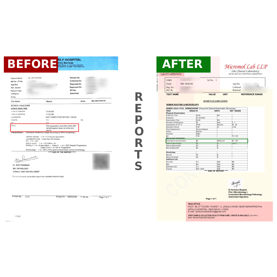 EKRAMBeforeAfter_j8bid_1080