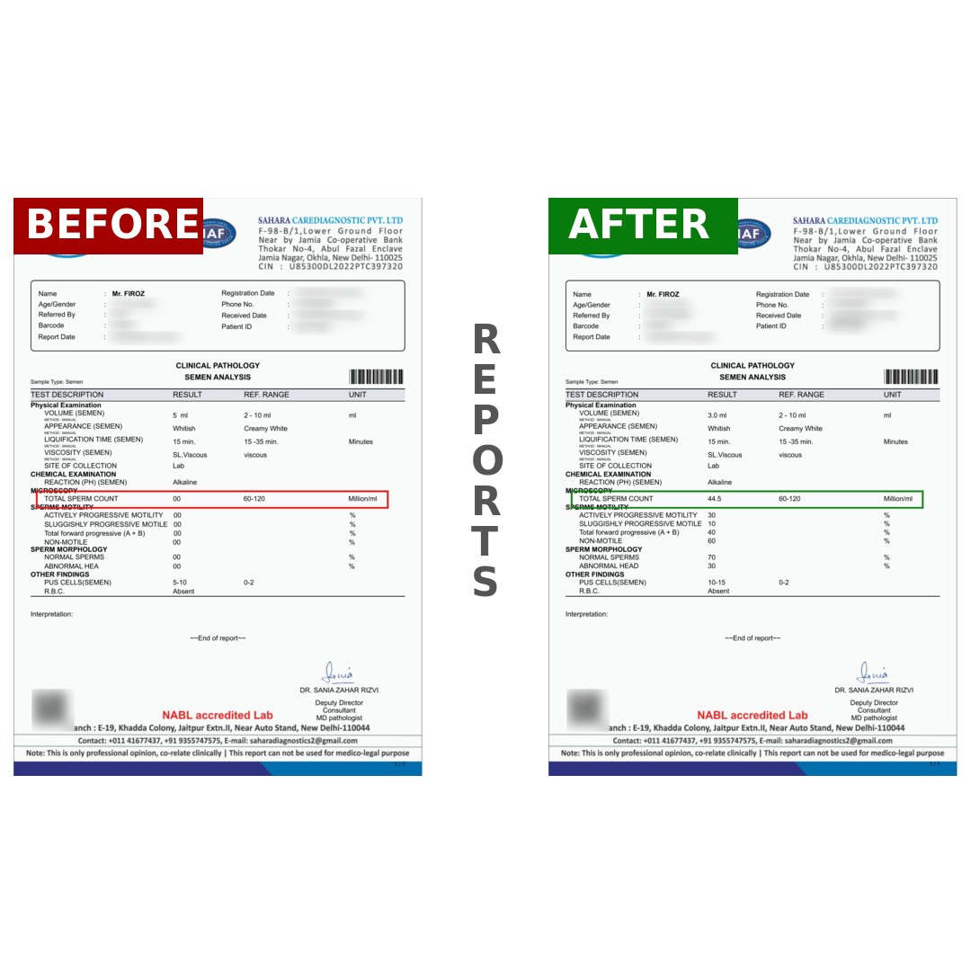 FIROZBeforeAfter_fnd5b_1080