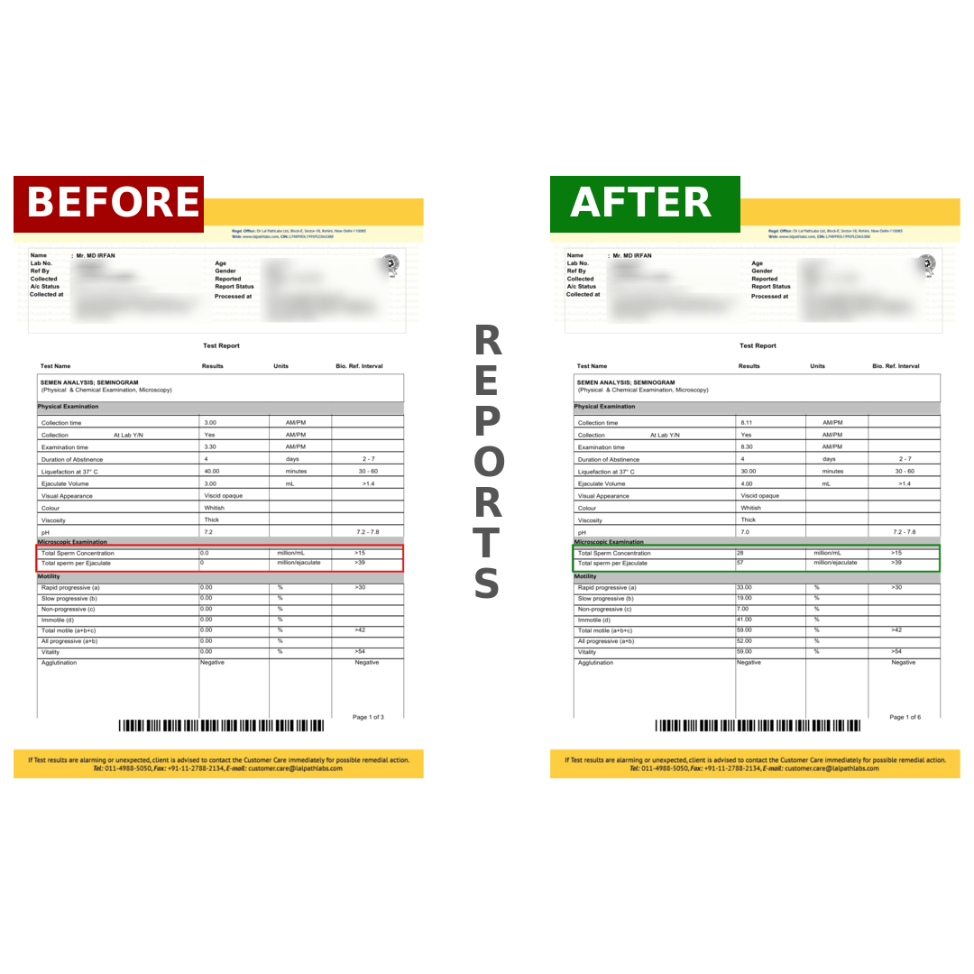 IRFANBeforeAfter_078zt_1080