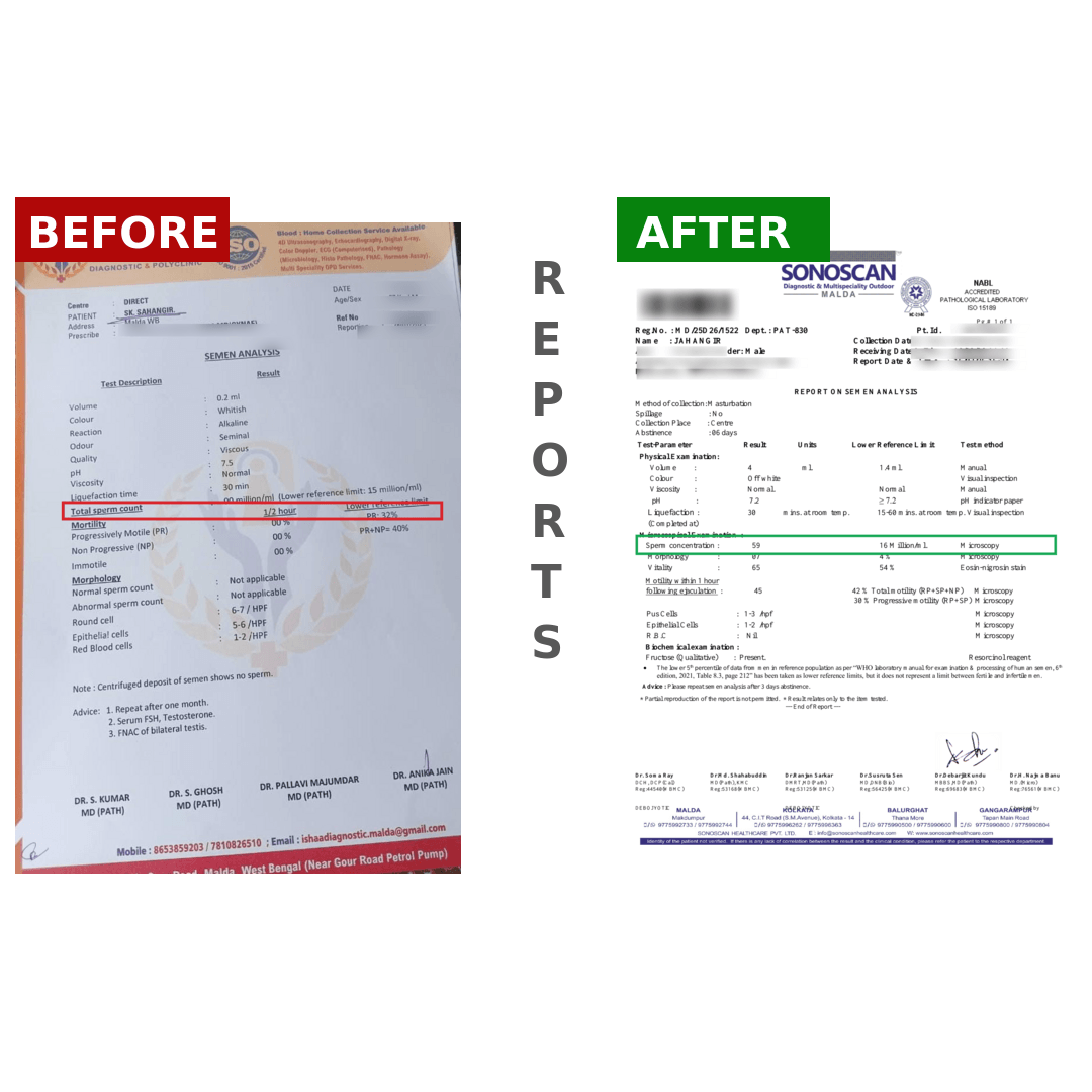 JAHANGIRBeforeAfter_rj2ej_1080