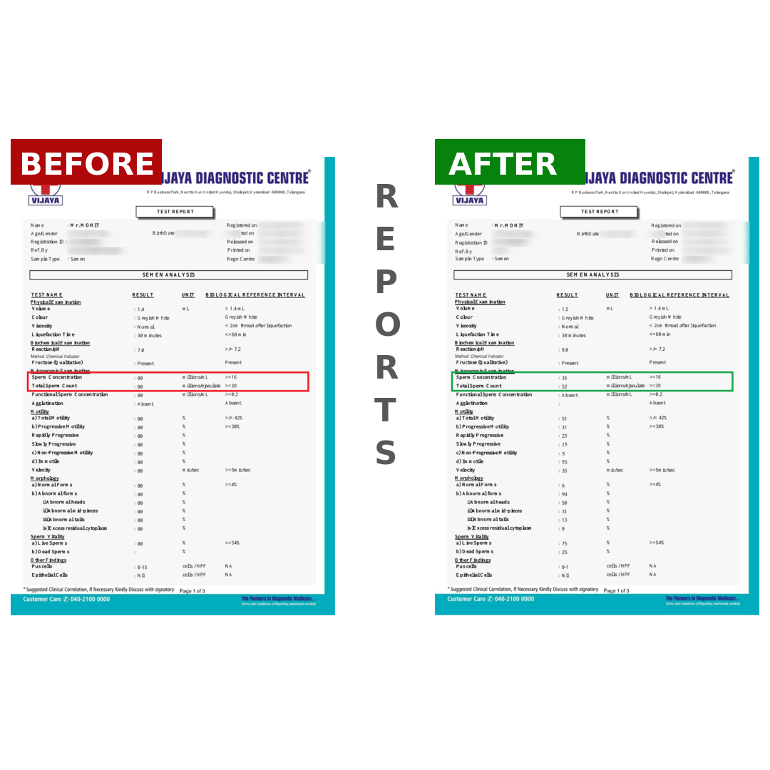 MOHITBeforeAfter_ye1tm_1080