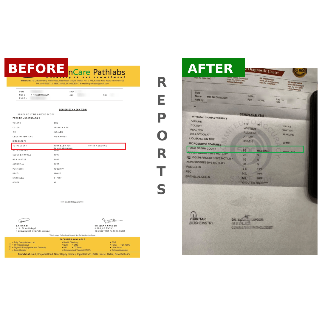 NAZIMMALIKBeforeAfter_83j7f_1080