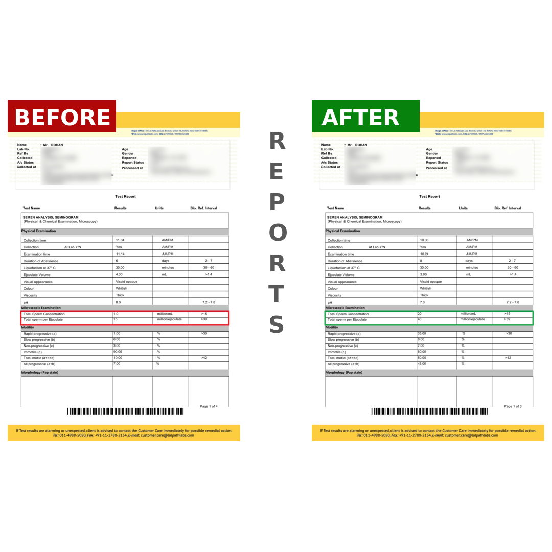 ROHANBeforeAfter_2tfdn_1080