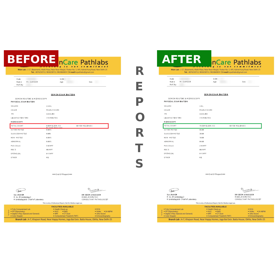 SAMEERBeforeAfter_dv93m_1080