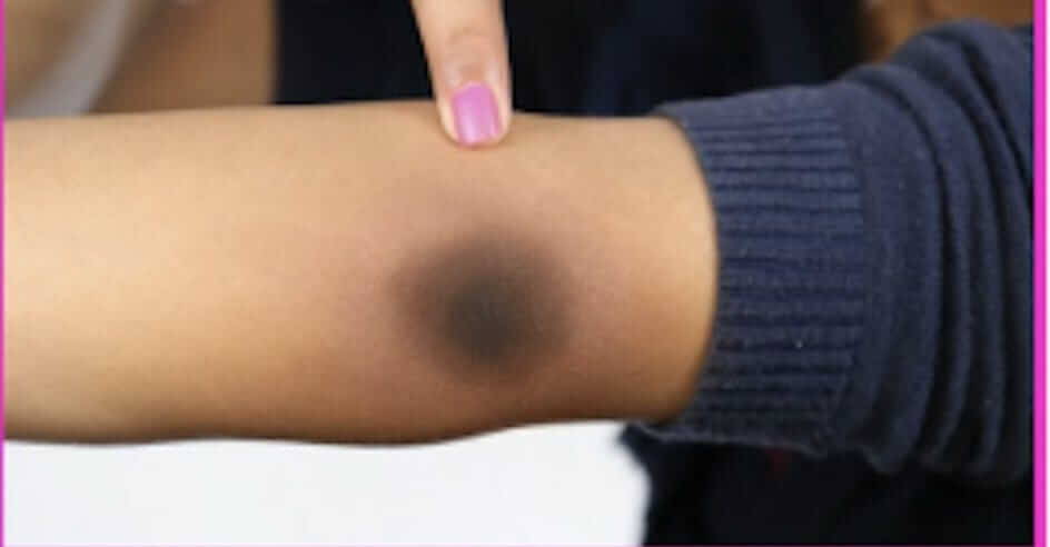 WhatsAppImage20251110at11_y1mtm_944