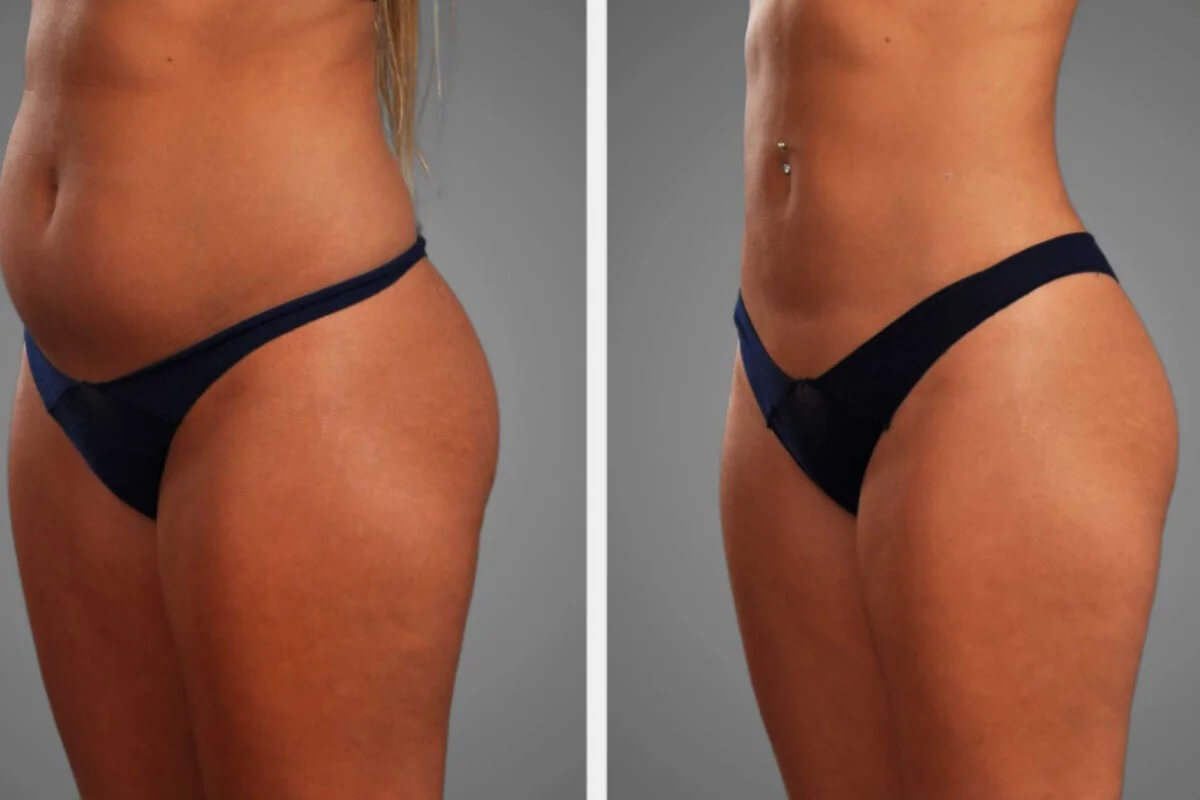 WhatsAppImage20251119at3_i4ota_1200