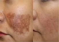 WhatsAppImage20251205at12_m3mzi_207