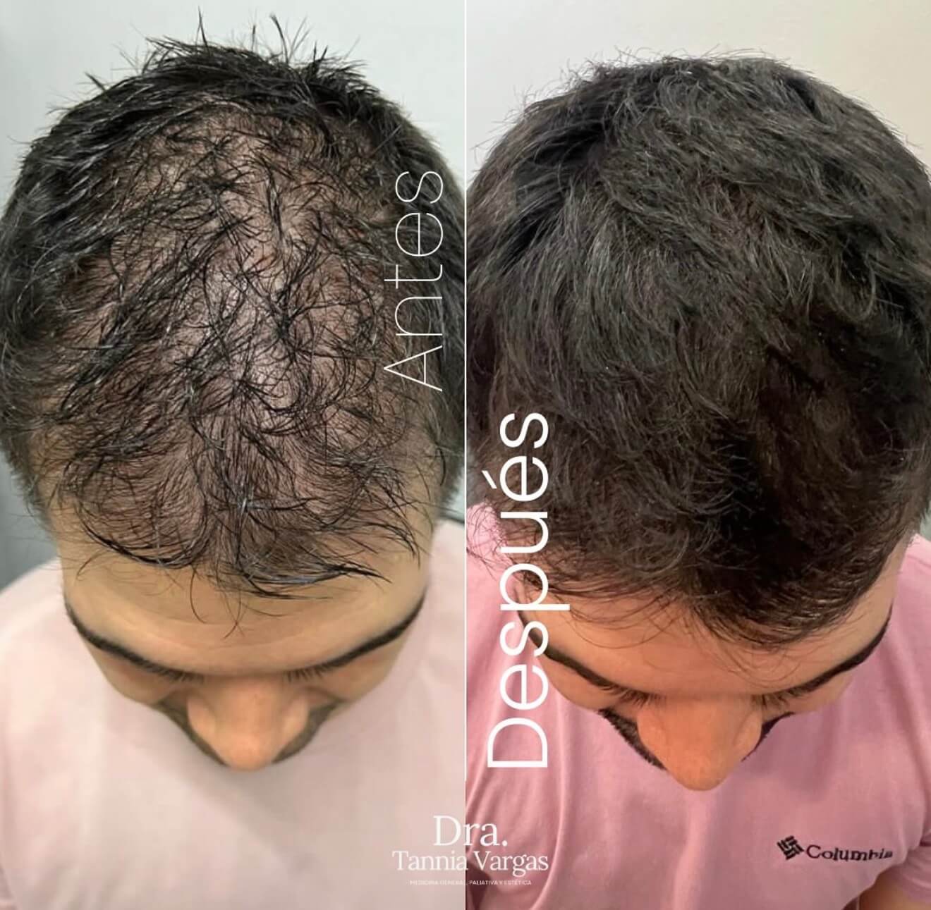 Image20260306164218_utscj_1320