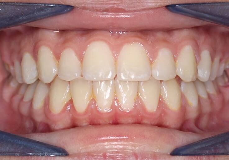 Katyaafter_j0cly_737