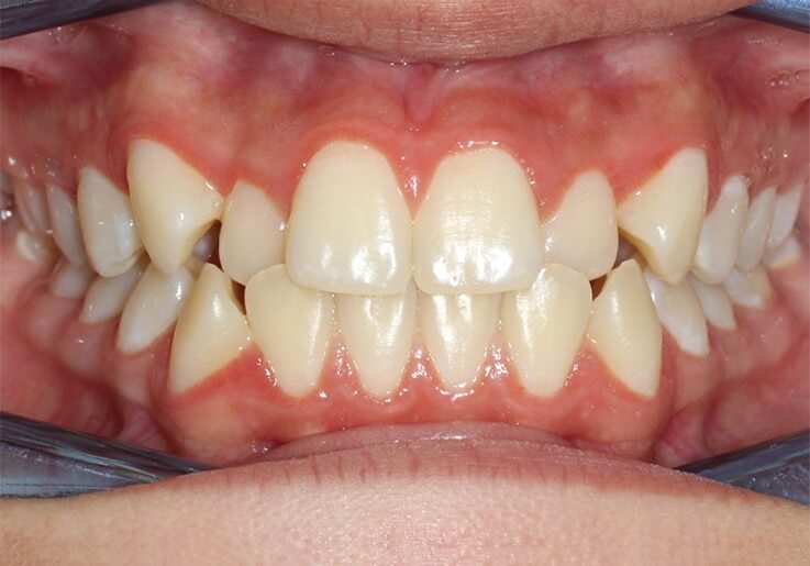 Katyabefore_ud3mf_737