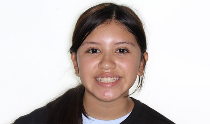 brioneskatyafacial1_eynf8_737