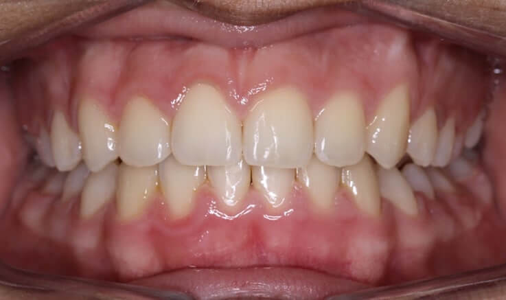 euniceafterteeth_uesjq_737