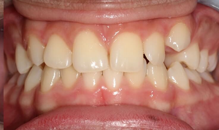 eunicebeforeteeth_ev2im_737