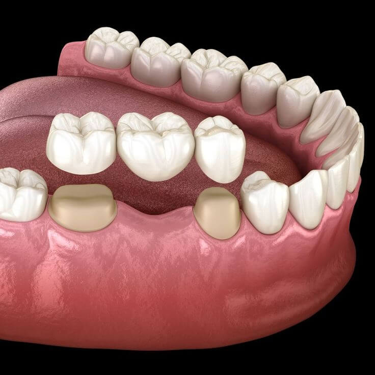 DentalbyDesign_g47fm_736