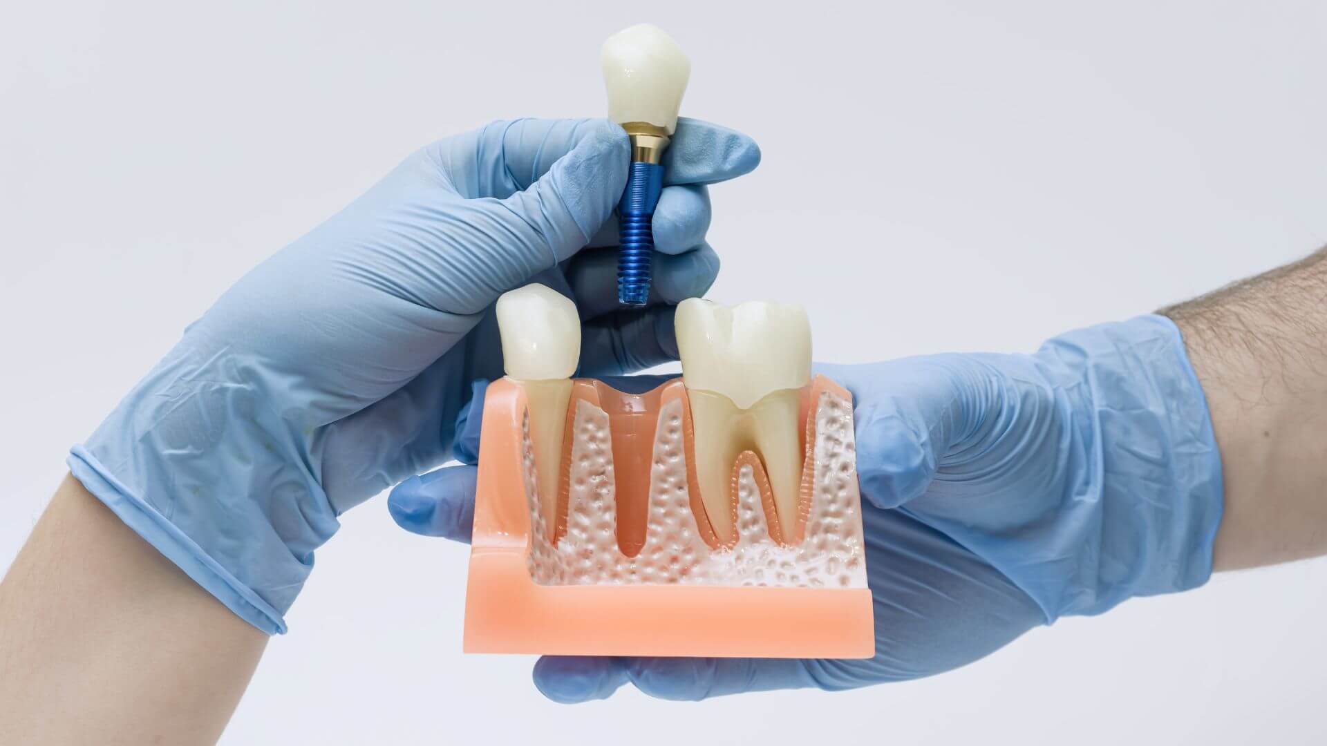 SVCareSkyDentalServices5_yp4x8_1920