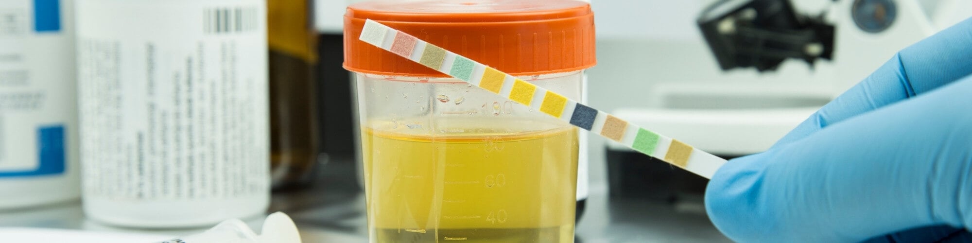 UrineTest2_ev02r_2000