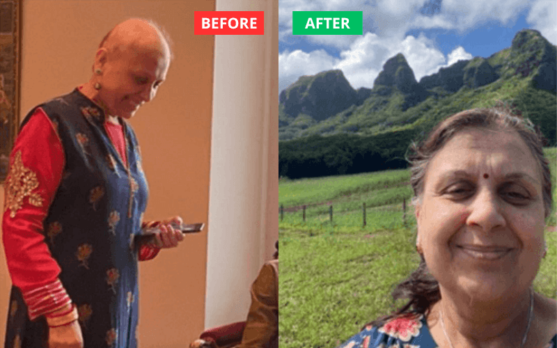 BEFOREAFTER1_5m8qa_800