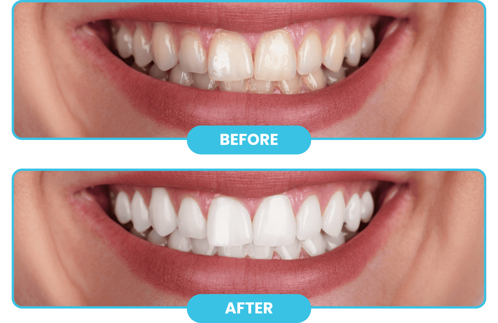 BeforeAftertooth_a1nzu_1620