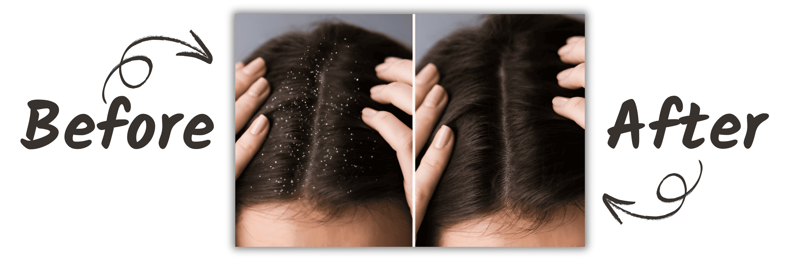 Beforeandafterhairfall_k4mji_3240