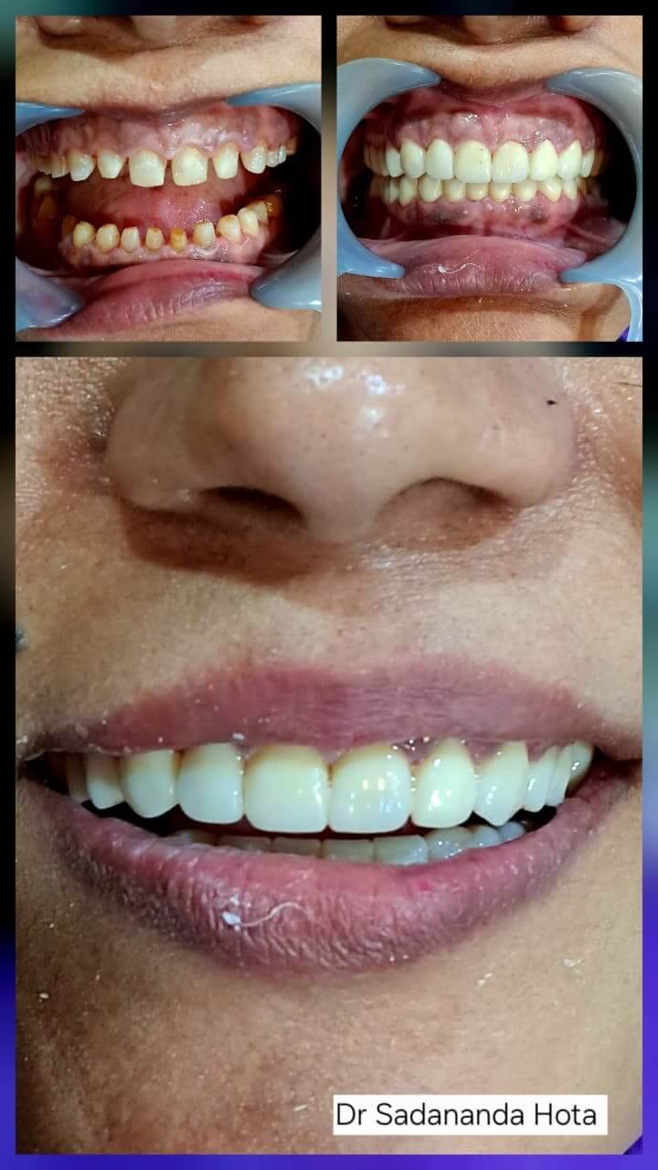 WhatsAppImage20260217at19