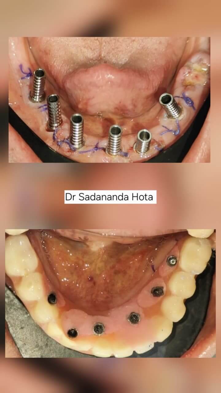 WhatsAppImage20260217at19