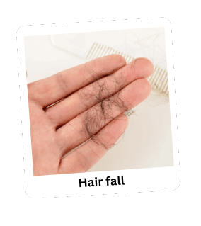 Hairfall_y2otg_284