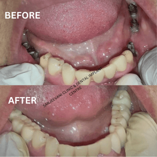 ewnte_322_Addasubheading