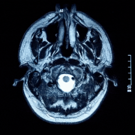 BrainScan1_k5otc_432