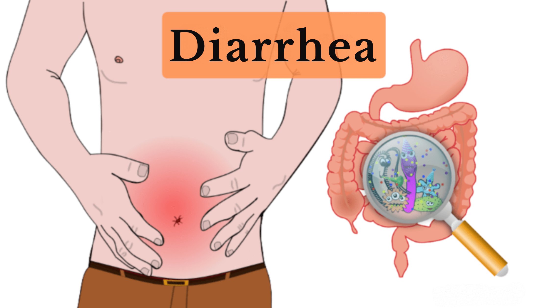 Diarrhea1_g4mjg_2240