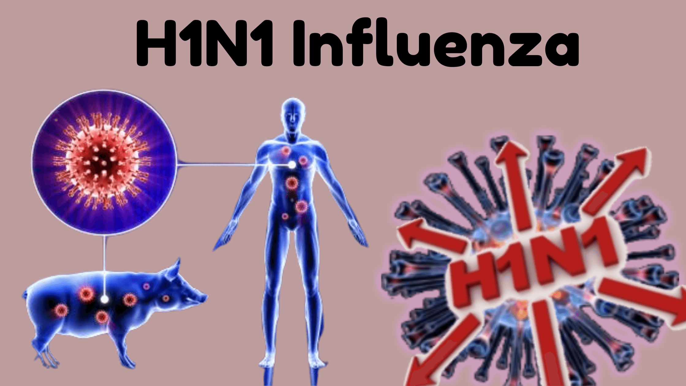 H1N1Influenza2_m0mdi_2240