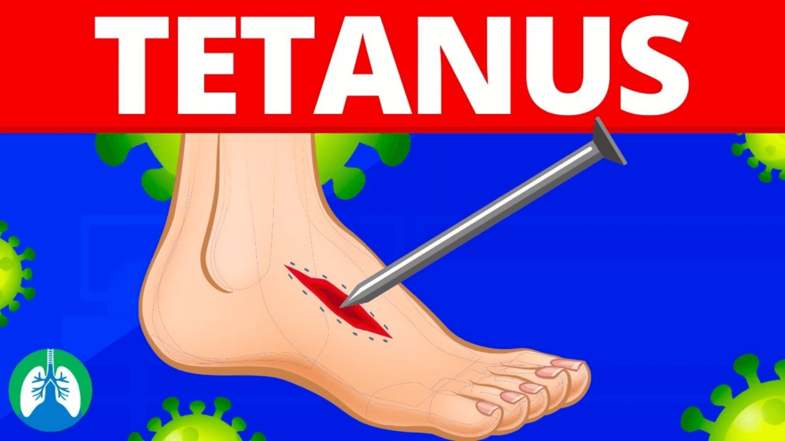 g1njm_1600_tetanus