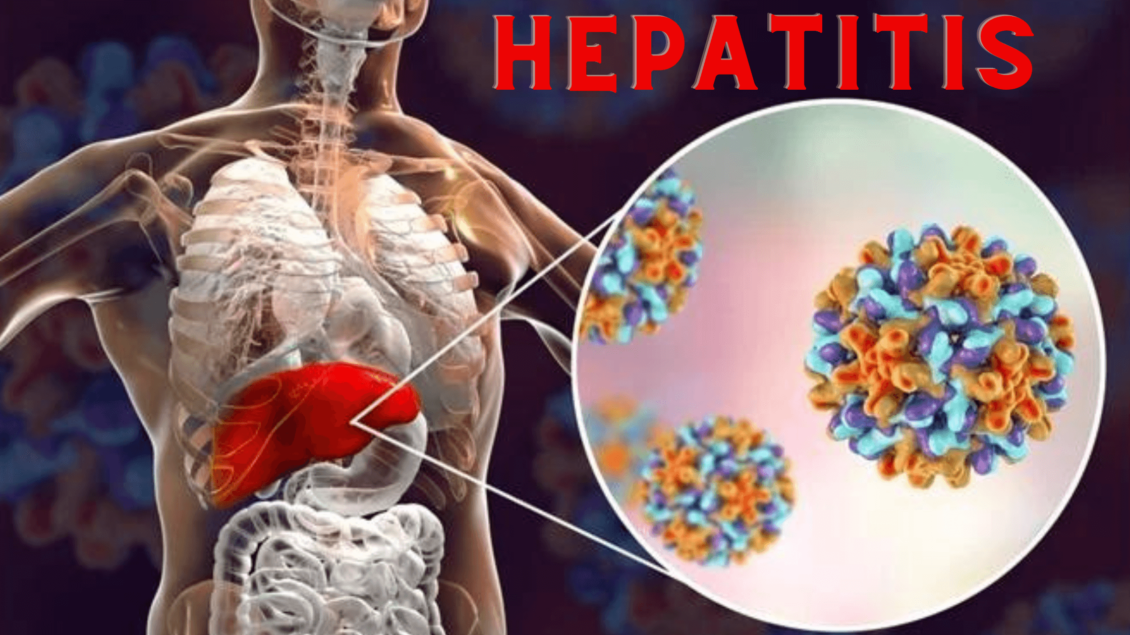g3mda_2240_Hepatitis