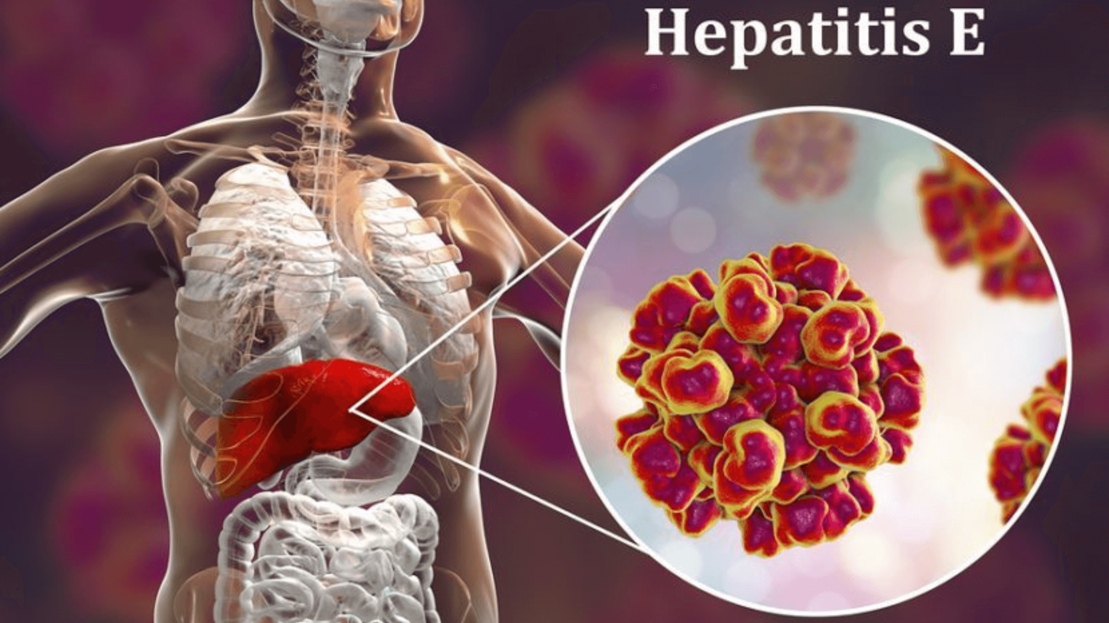 m2mja_2240_hepatitise