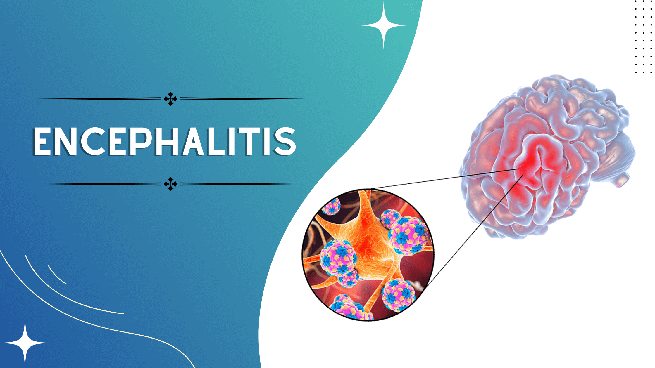 m2nzk_2240_encephalitis2