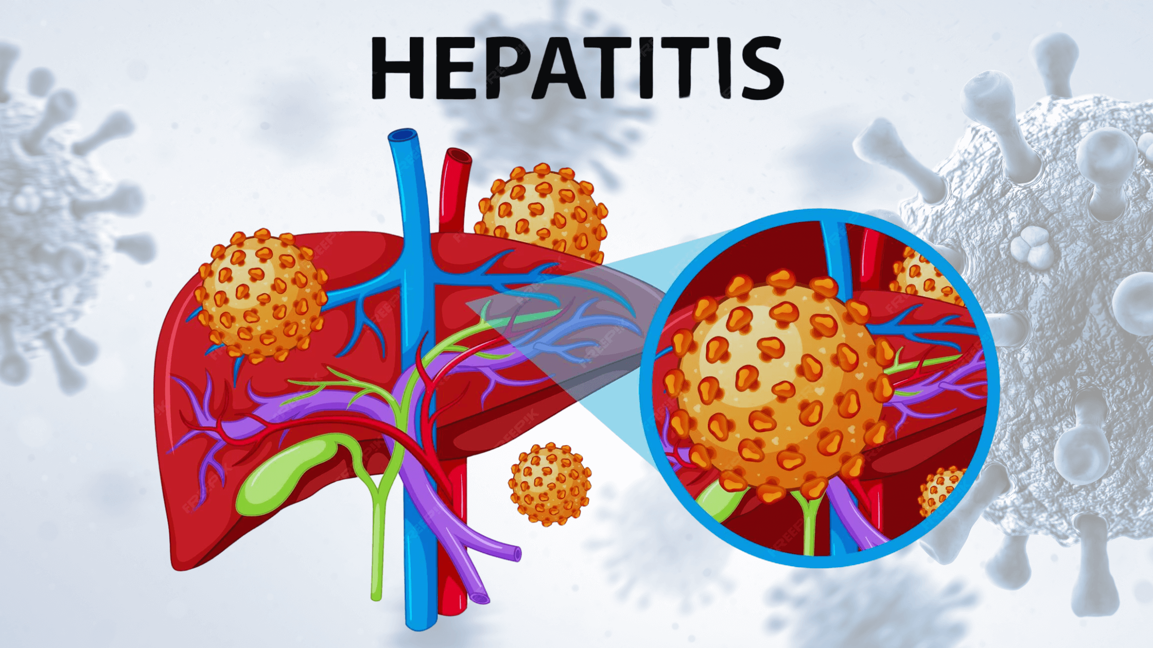 u1ndu_2240_Hepatitis1