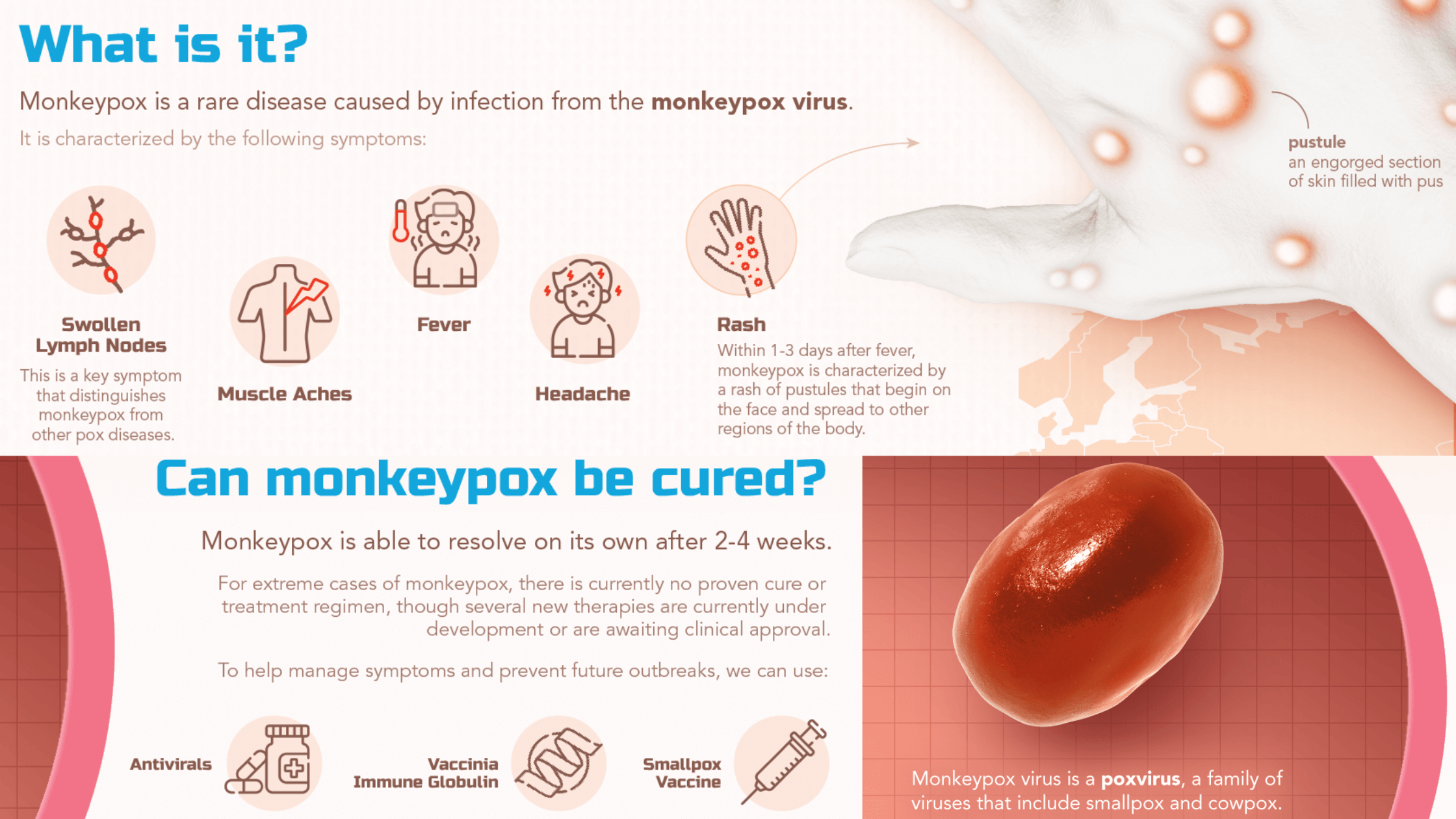 u5nju_2240_monkeypox